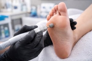 Коррекция стоп аппаратным педикюром: идеальная гладкость стоп без боли и риска